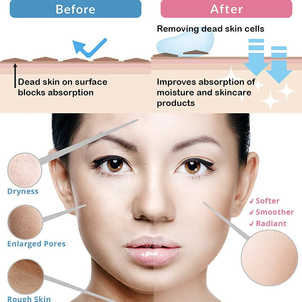 Natural Aqua Gel (Exfoliante Facial)
