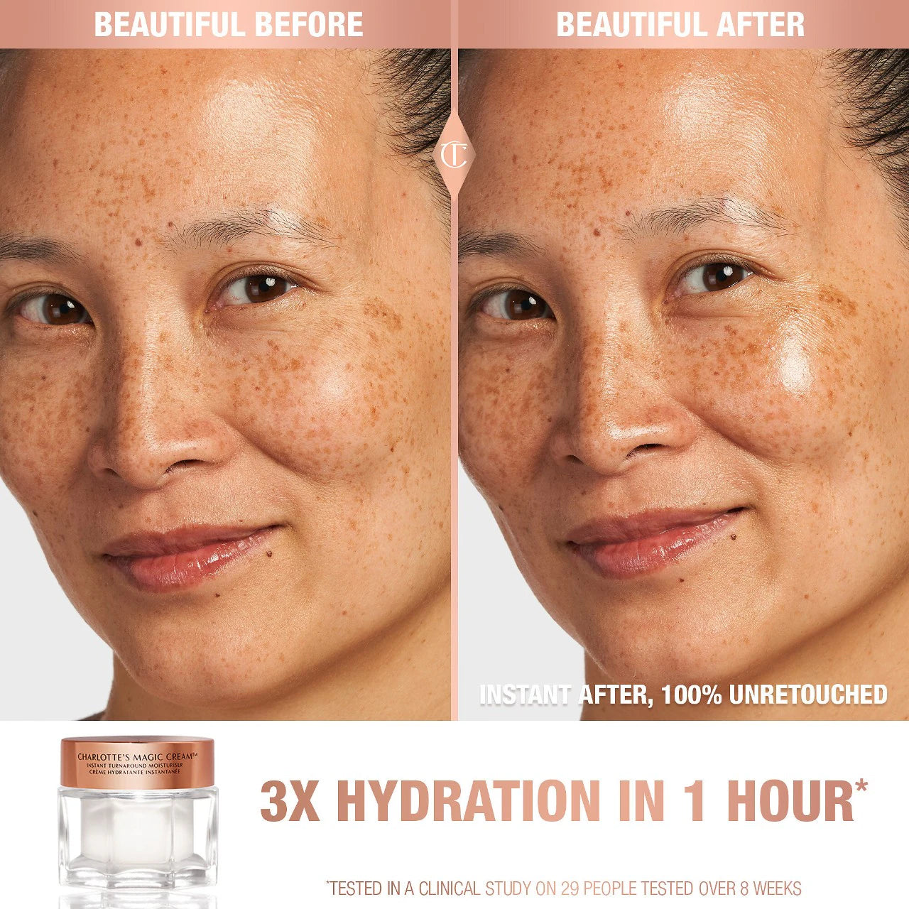 Magic Cream Moisturizer with Hyaluronic Acid (Crema Hidratante)