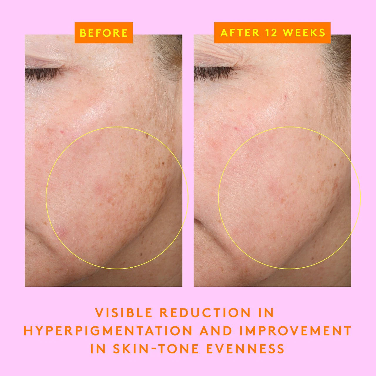 C-Firma Fresh Vitamin-C Day Serum (Suero Facial)