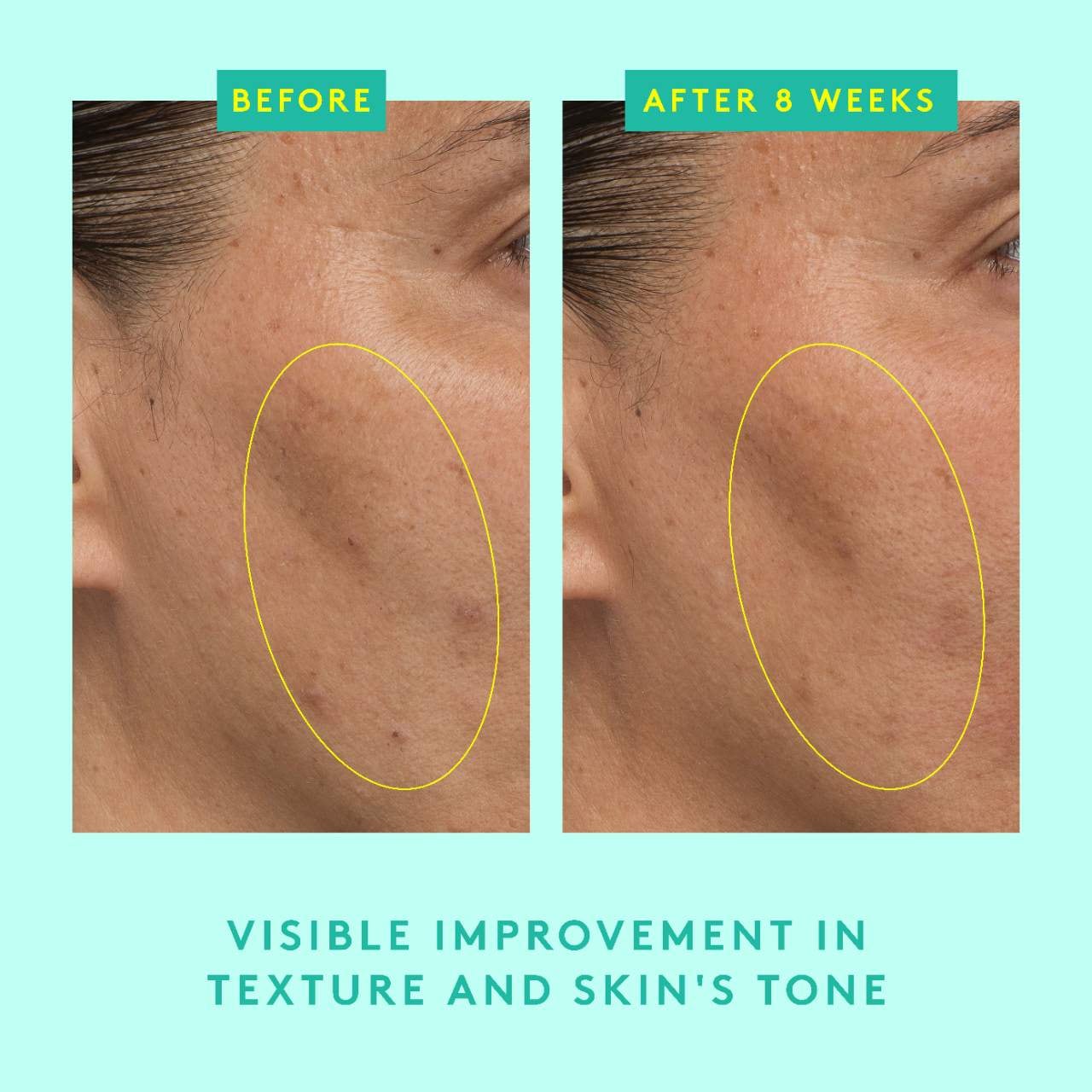 Protini Powerpeptide Resurfacing Serum with Lactic Acid (Suero Facial)