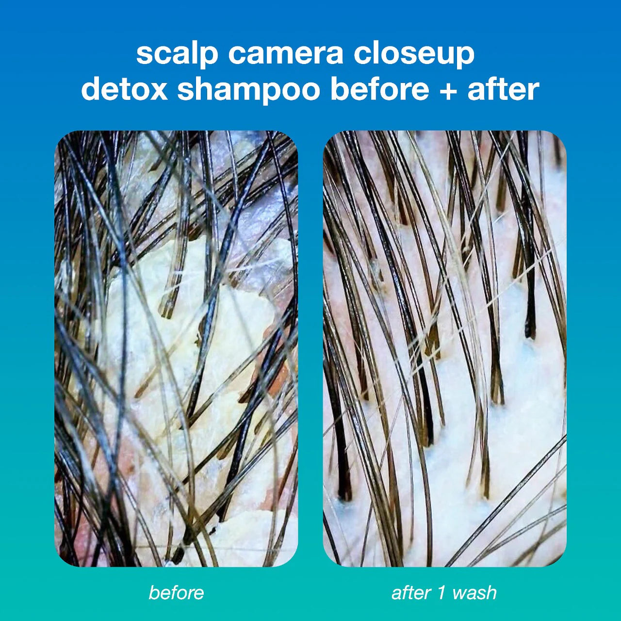 Peptide Prep Clarifying Detox Shampoo (Champú Para Cabello)