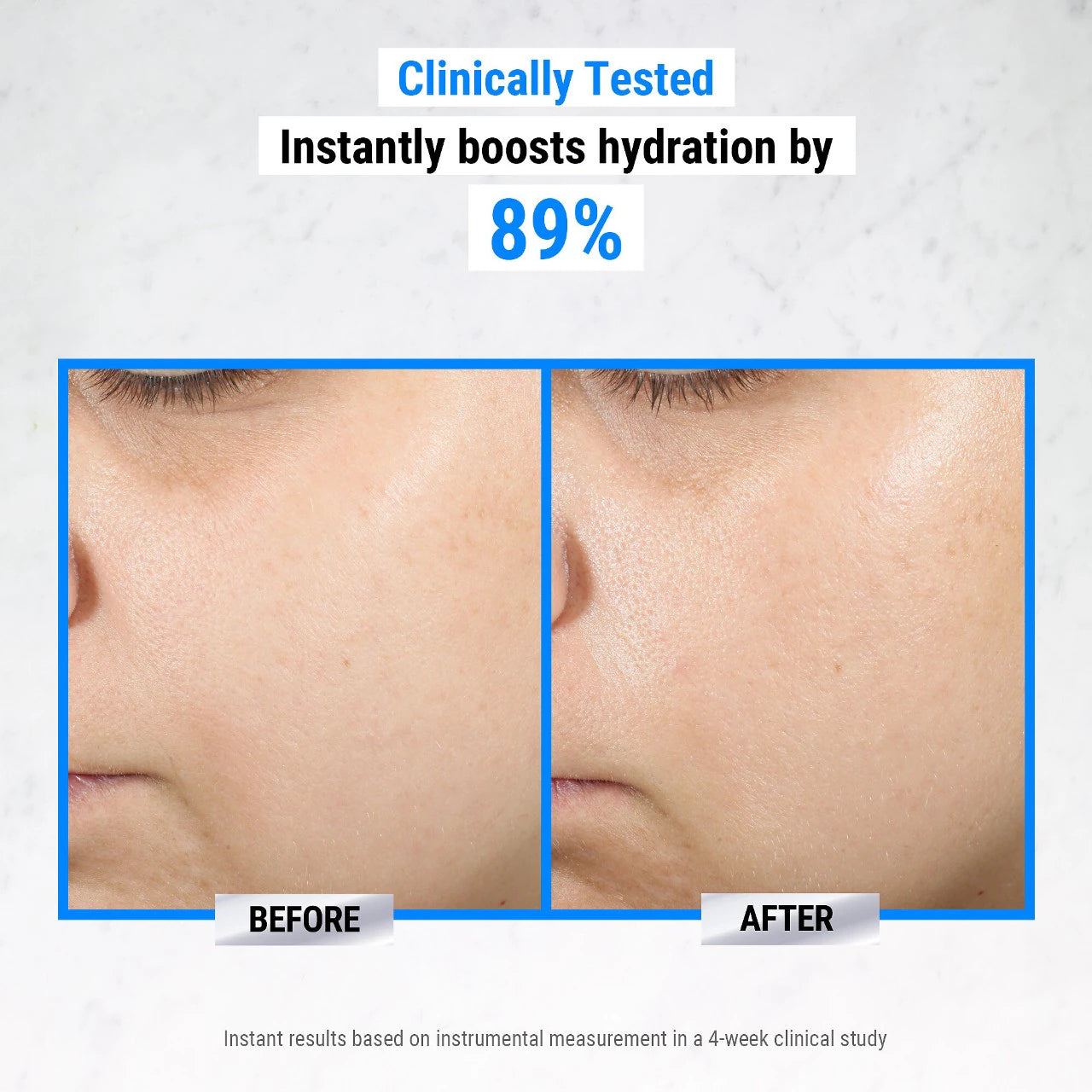 Ultra Pure Hyaluronic Acid 1.5% Serum (Suero Facial)