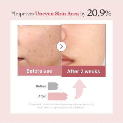 PDRN Pink Collagen Exosome Shot 2000 (Suero Facial)