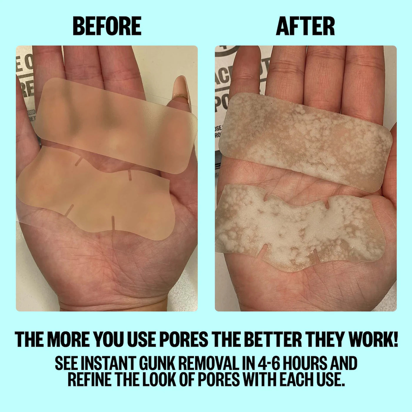 Oil-Absorbing Pore Treatment Strips (Parches Para Acné)