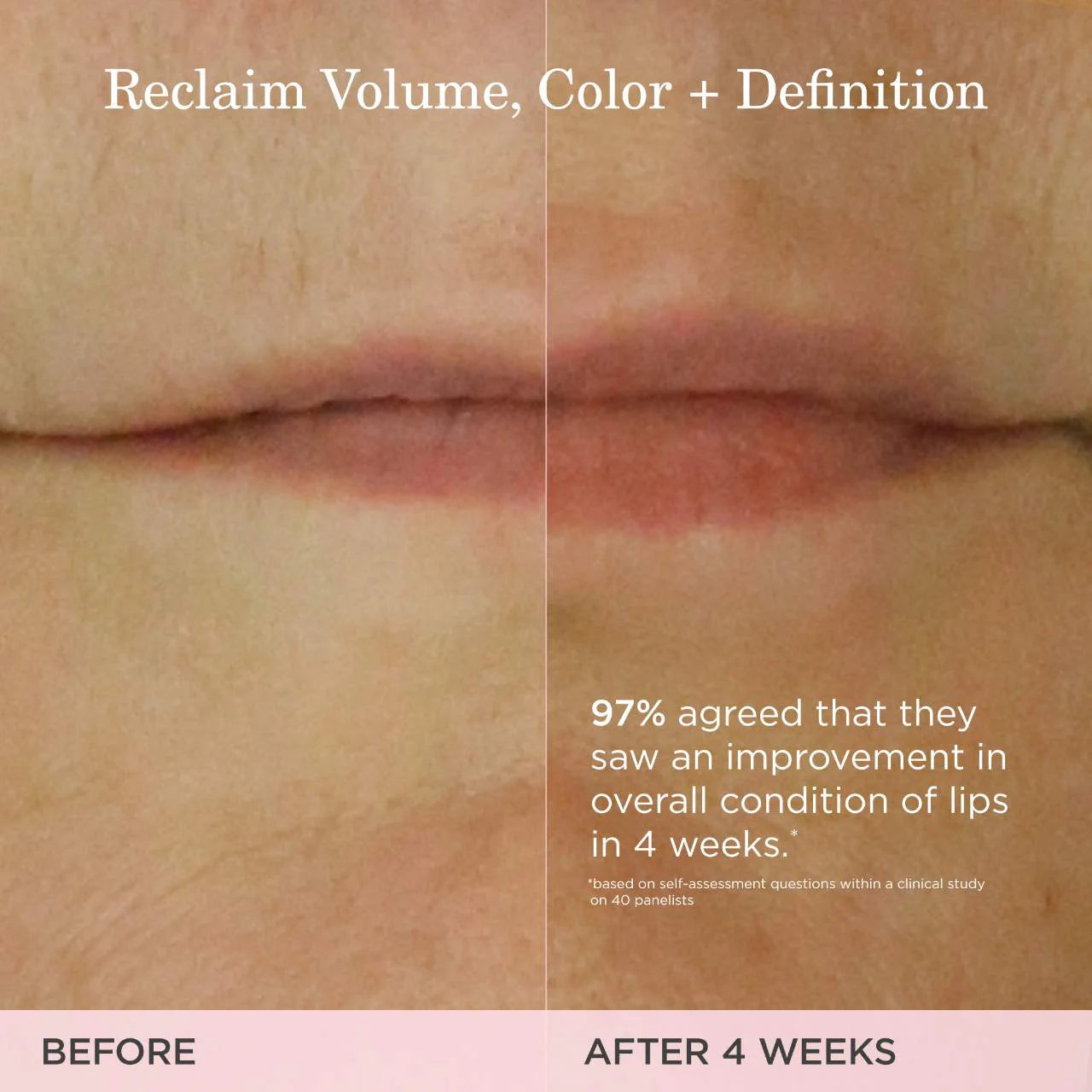 The Kissu Lip Treatment (Bálsamo Para Labios)