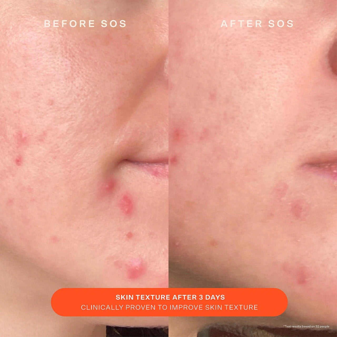 SOS Daily Skin Barrier Redness Recovery Moisturizer (Crema Hidratante)