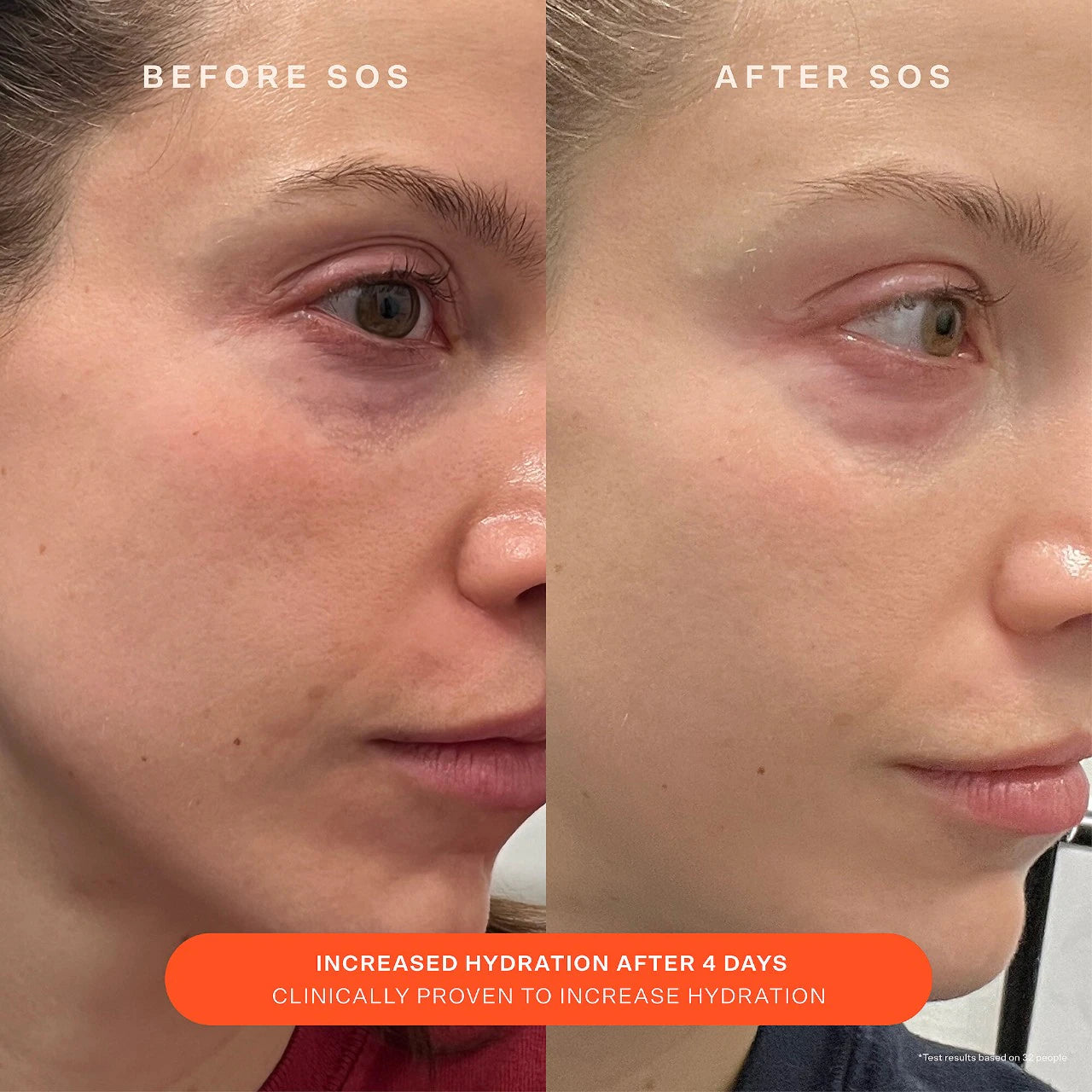 SOS Daily Skin Barrier Redness Recovery Moisturizer (Crema Hidratante)