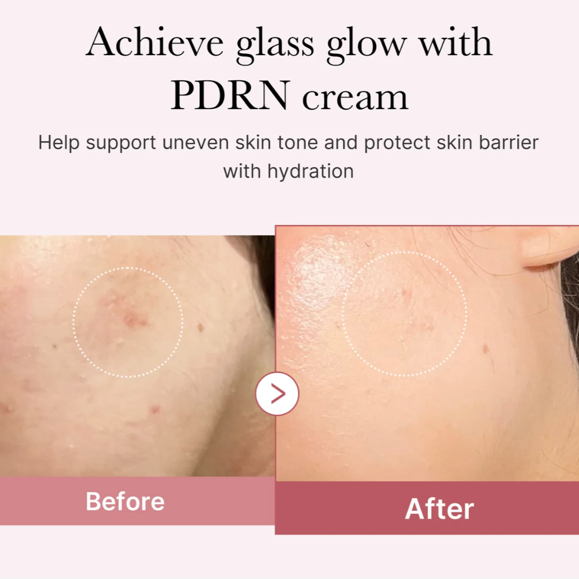 PDRN Pink Peptide Cream (Crema Hidratante)
