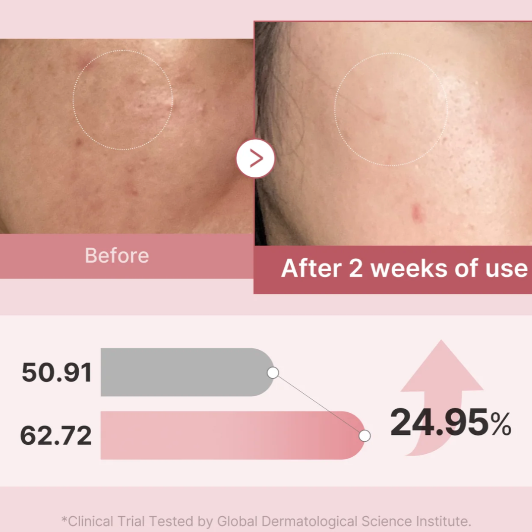 PDRN Pink Peptide Serum Mist (Bruma Facial)