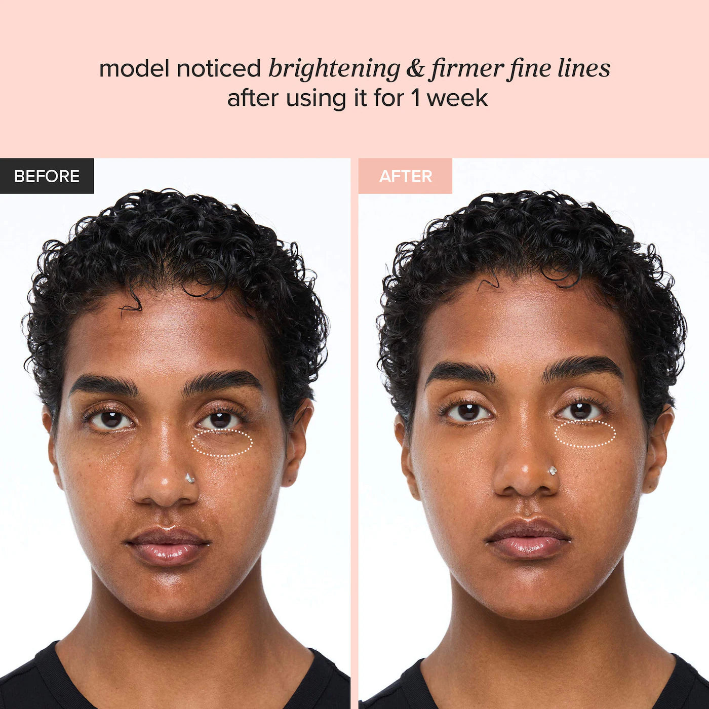 Revive Eye Serum (Contorno de Ojos)