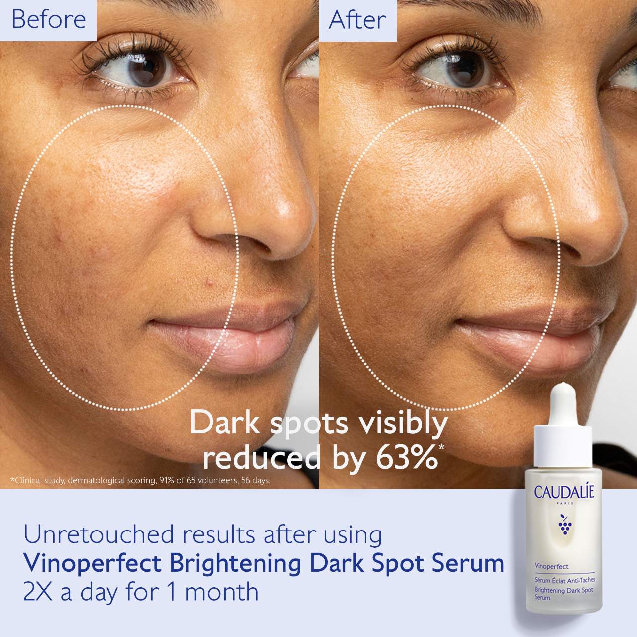 Vinoperfect Brightening Dark Spot Serum Vitamin C (Suero Facial)