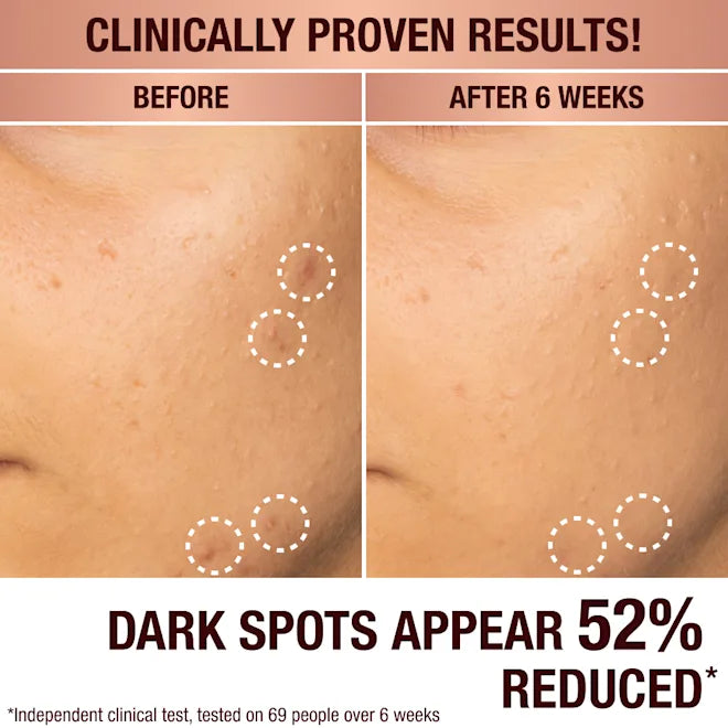 Dark Spot Correcting Radiance Recovery Serum (Suero Facial)