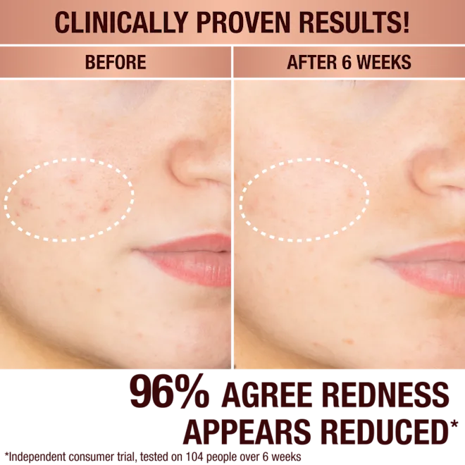 Dark Spot Correcting Radiance Recovery Serum (Suero Facial)