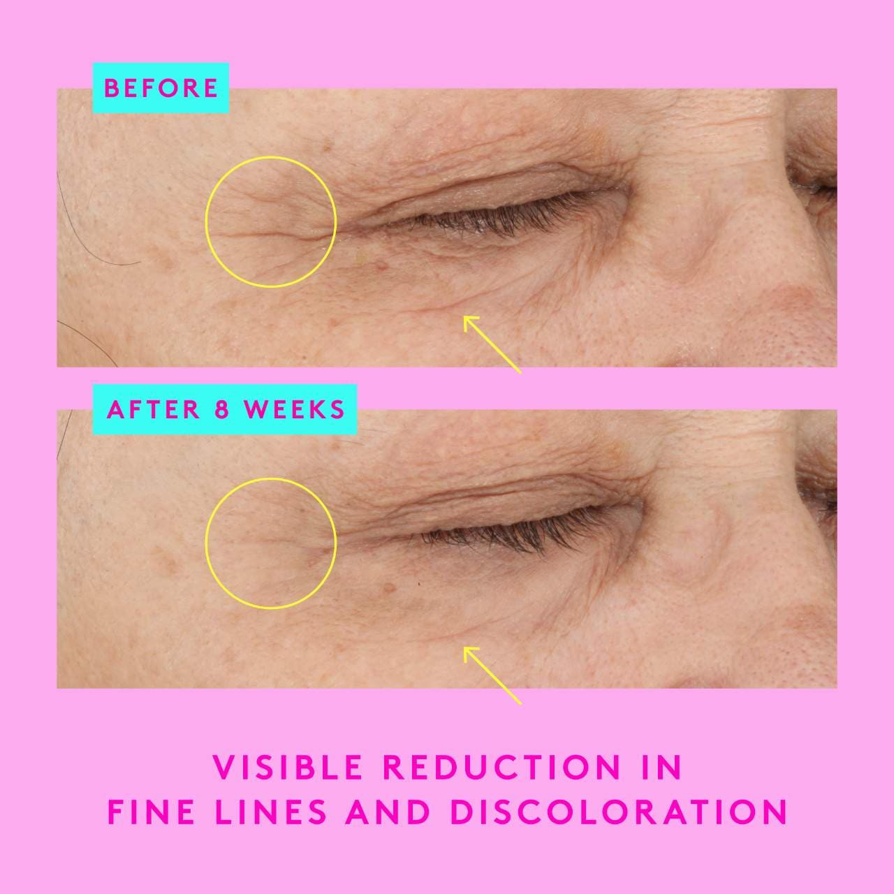 A-Shaba Complex Retinol Eye Serum (Suero Para Ojos)