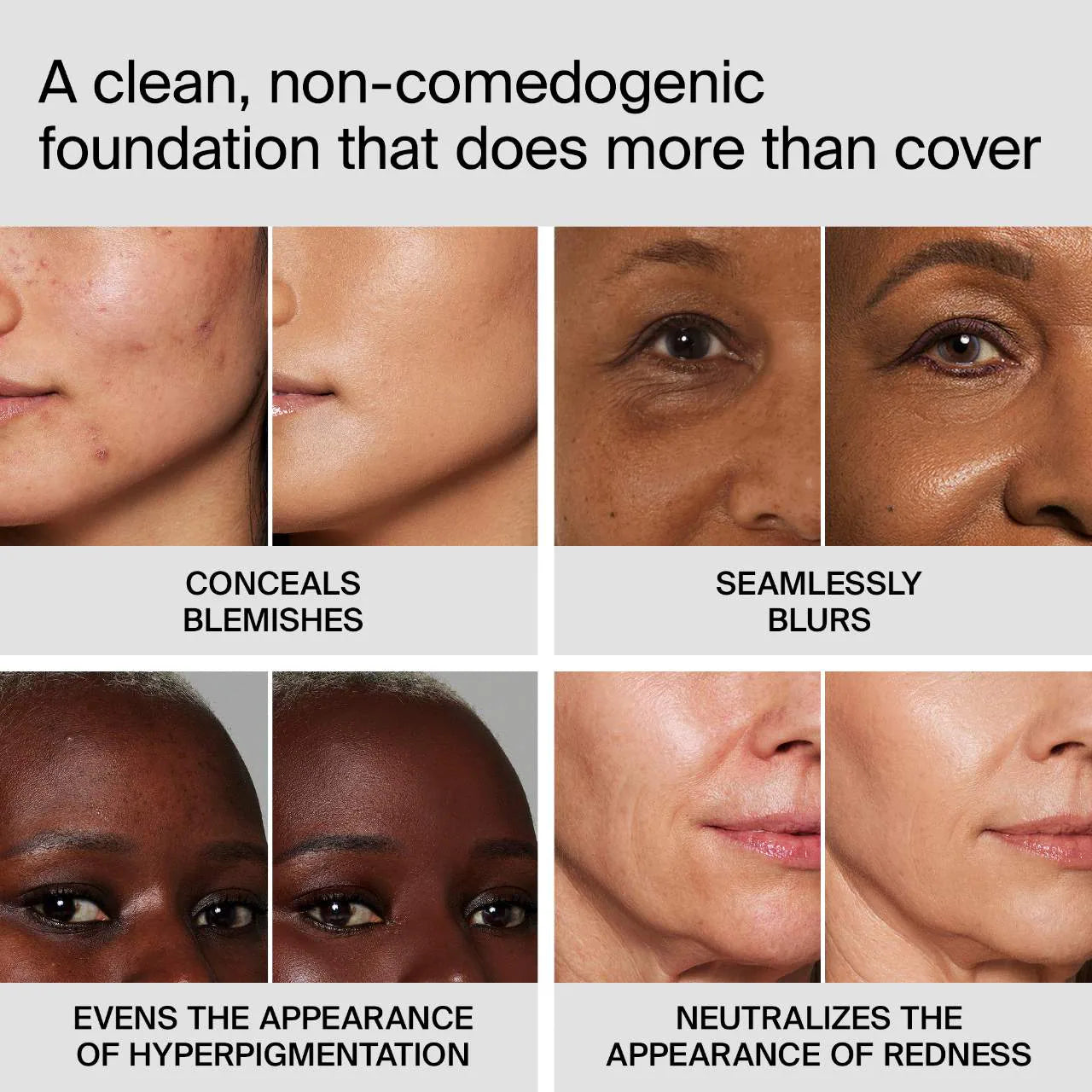 Triclone Skin Tech Medium Coverage Foundation with Fermented Arnica (Base Líquida)