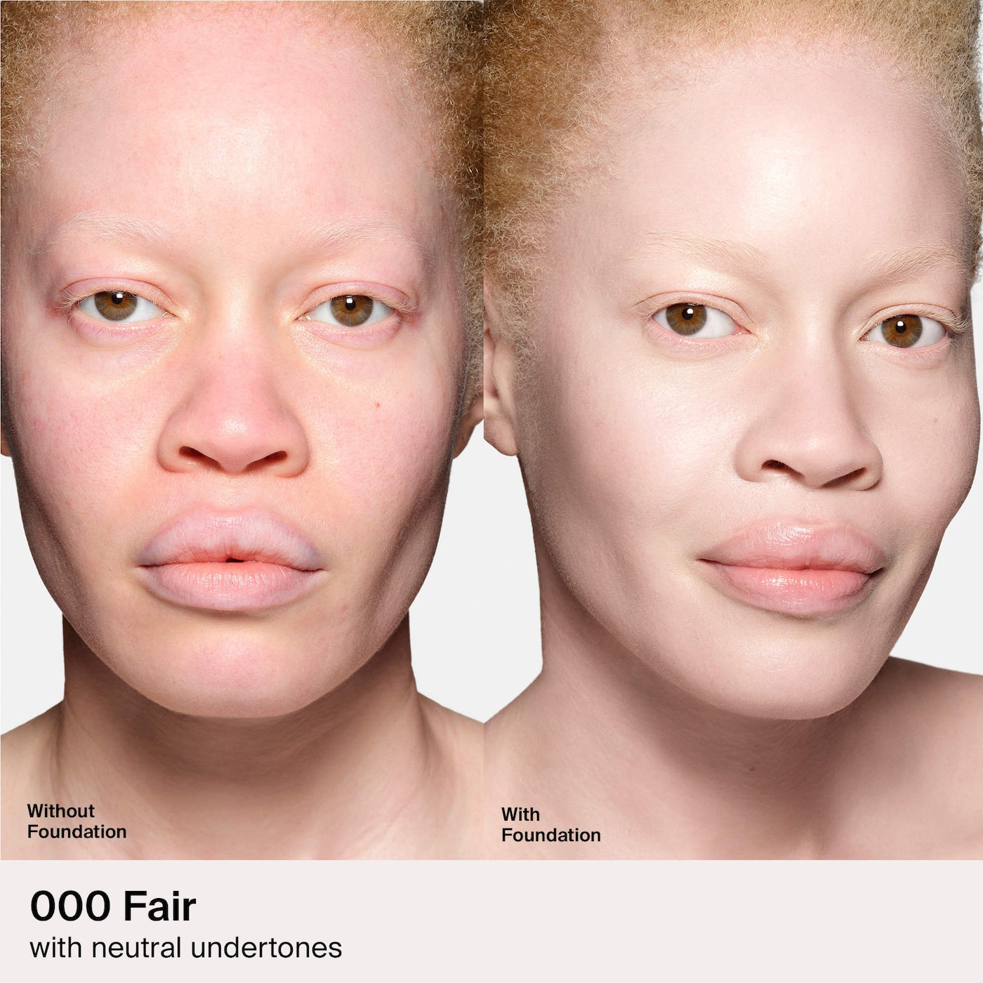 Triclone Skin Tech Medium Coverage Foundation with Fermented Arnica (Base Líquida)