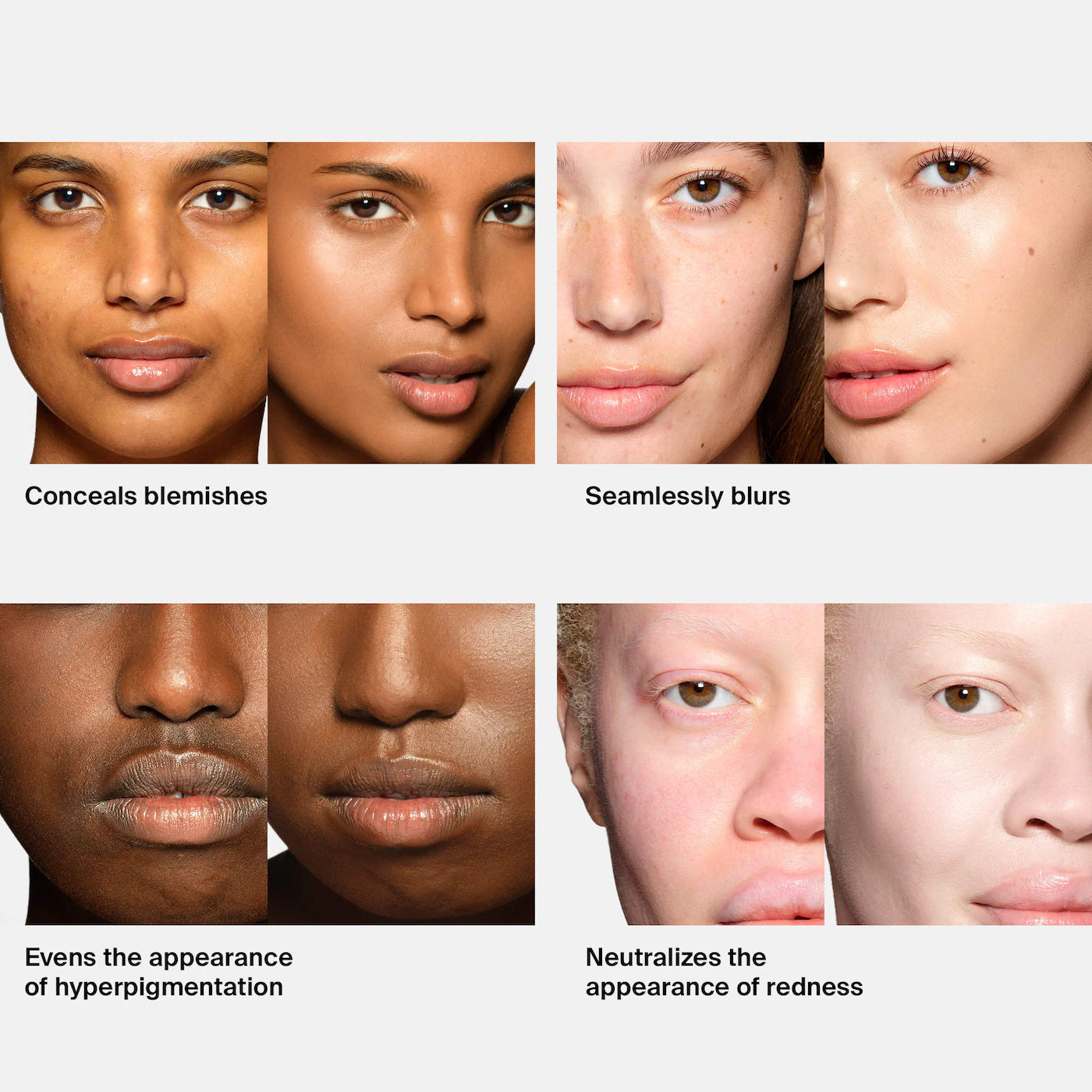 Triclone Skin Tech Medium Coverage Foundation with Fermented Arnica (Base Líquida)