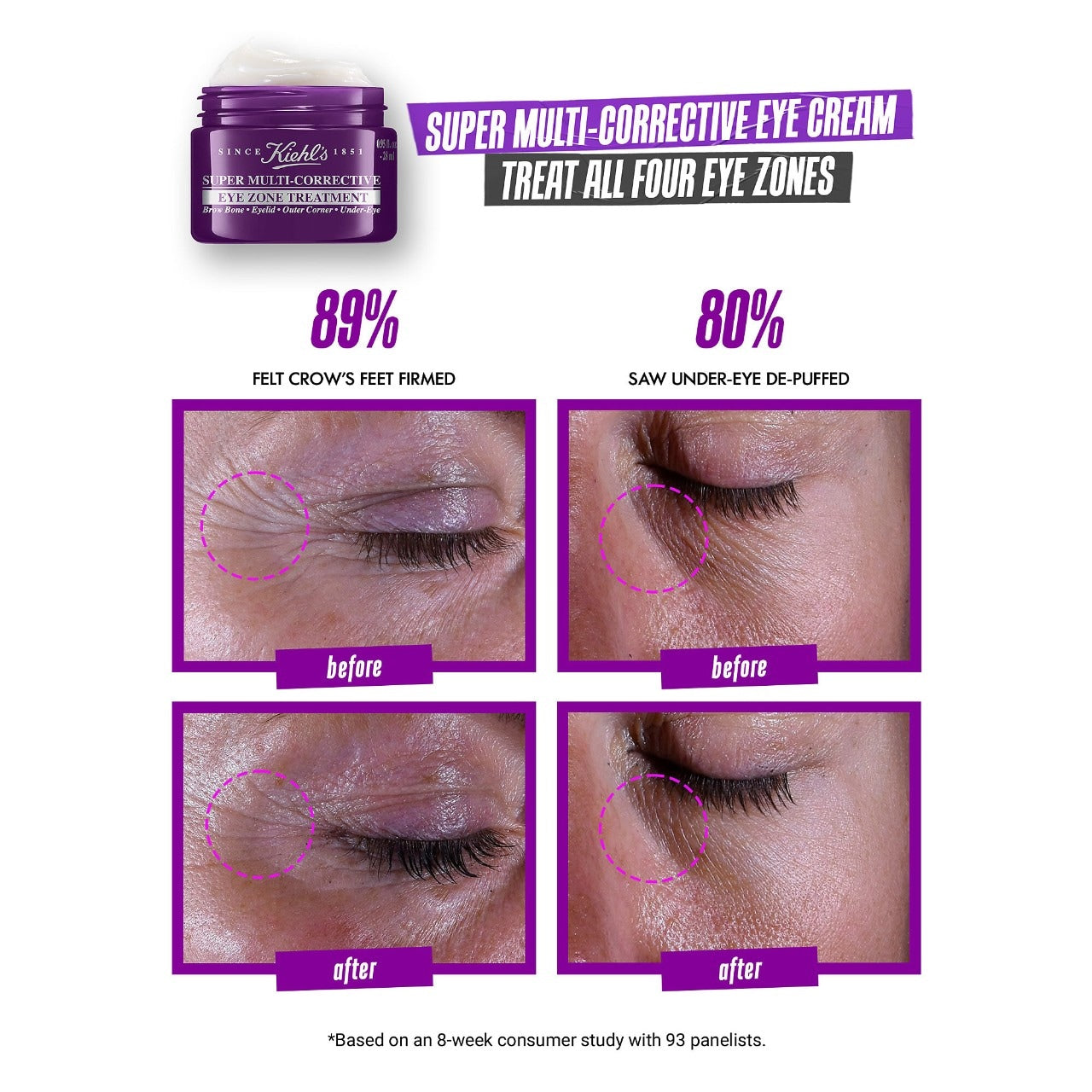 Super Multi-Corrective Anti-Aging Eye Cream (Contorno De Ojos)