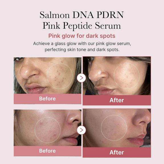 PDRN Pink One Day Serum (Suero Facial)