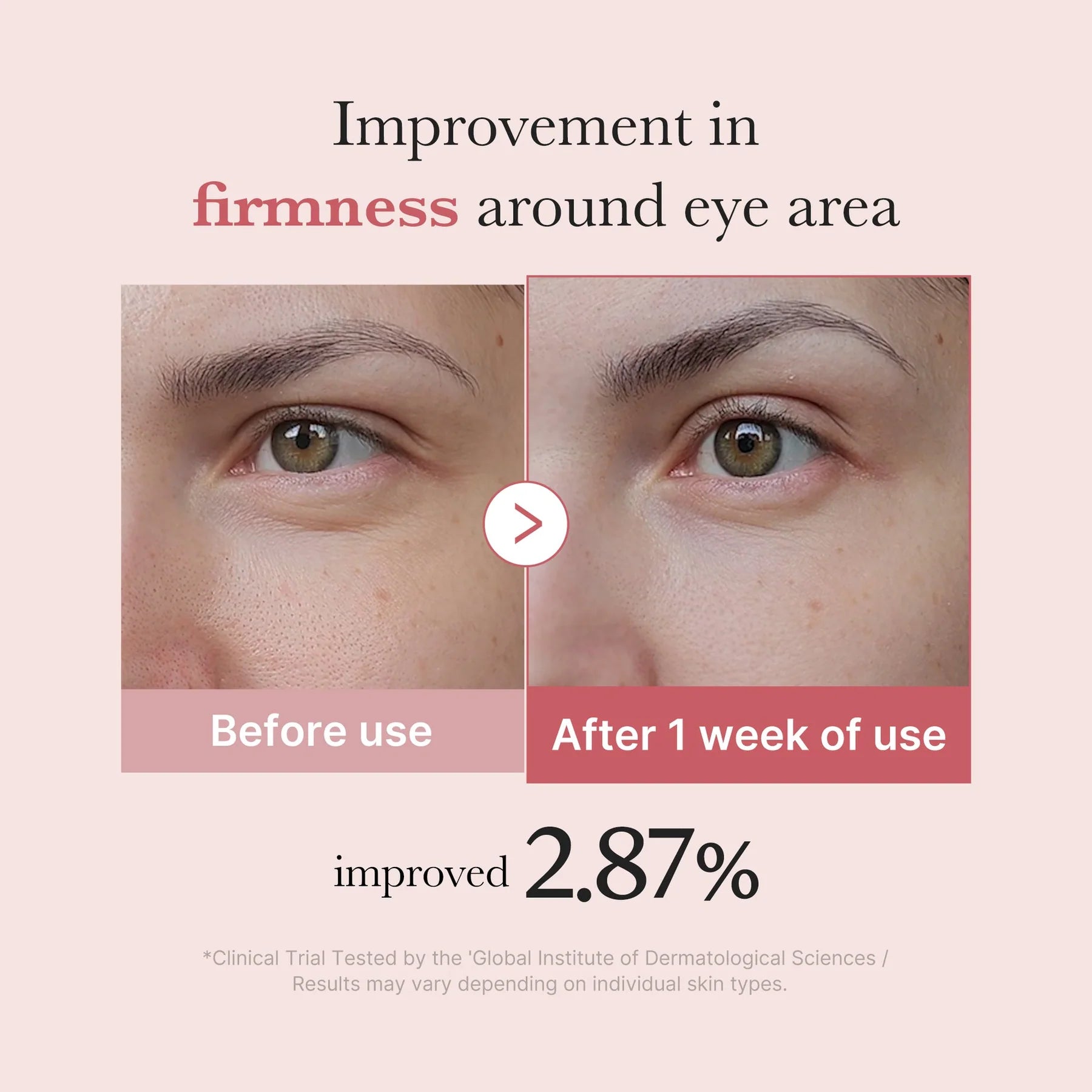 PDRN Pink Peptide Eye Cream (Contorno de Ojos)