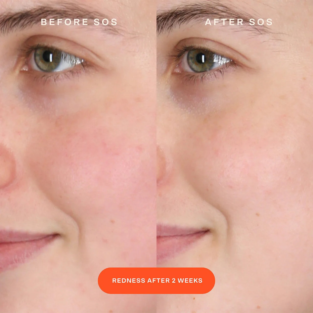 SOS Intensive Redness Relief Serum with Hypochlorous Acid (Suero Facial)