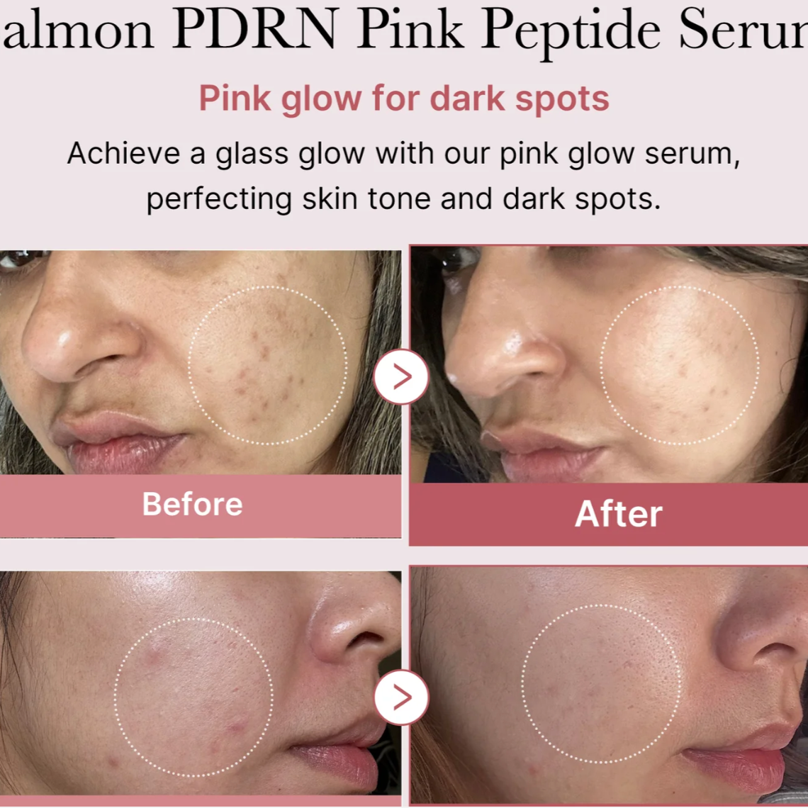 PDRN Pink Peptide Glow Serum (Suero Facial)