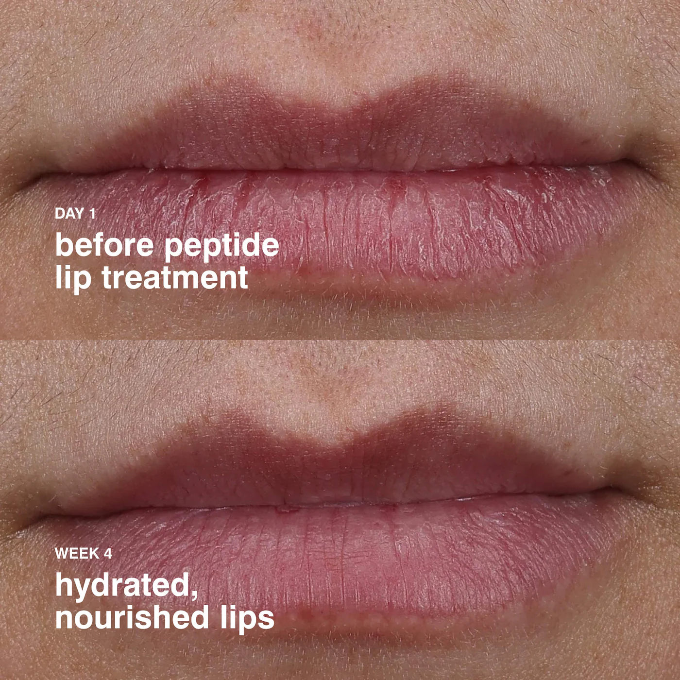 Peptide Lip Treatment (Bálsamo Para Labios)